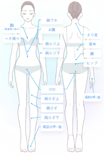 アリシアクリニックの脱毛箇所イメージ画像