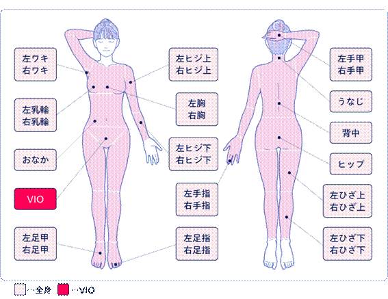 フレイアクリニックの脱毛箇所イメージ画像