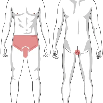 ゴリラクリニックの脱毛箇所イメージ画像