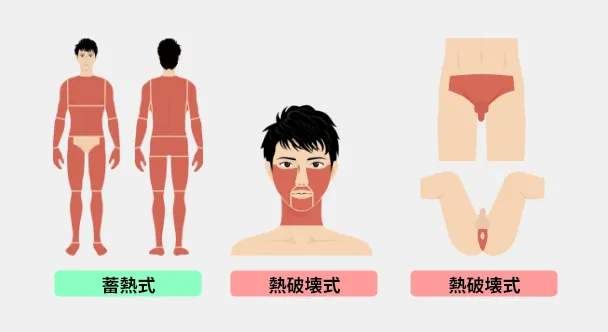 メンズリゼクリニックの脱毛箇所イメージ画像