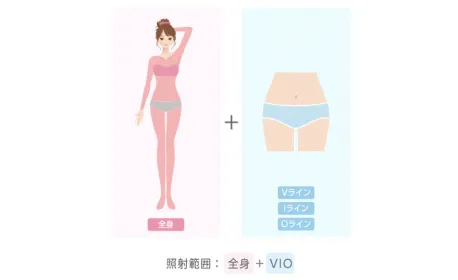 エミナルクリニックの脱毛箇所イメージ画像