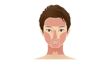 エミナルクリニックメンズの脱毛箇所イメージ画像