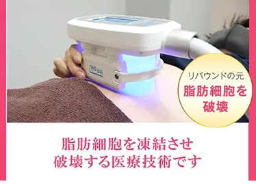 マシン施術:脂肪冷却イメージ画像