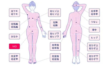 フレイアクリニックの脱毛箇所イメージ画像