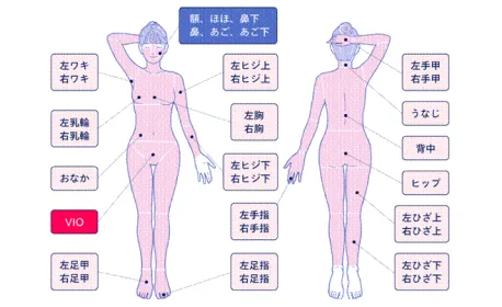 フレイアクリニックの脱毛箇所イメージ画像