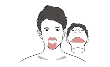 ゴリラクリニックの脱毛箇所イメージ画像