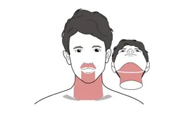 ゴリラクリニックの脱毛箇所イメージ画像