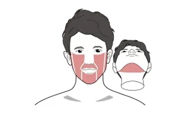 ゴリラクリニックの脱毛箇所イメージ画像