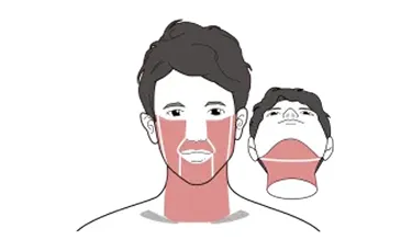 ゴリラクリニックの脱毛箇所イメージ画像