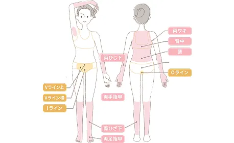 ルシアクリニックの脱毛箇所イメージ画像