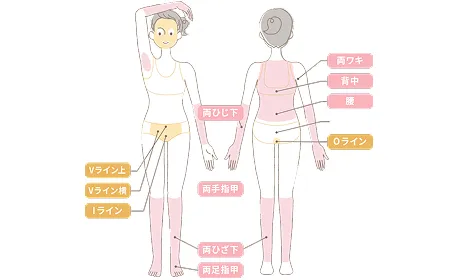 ルシアクリニックの脱毛箇所イメージ画像