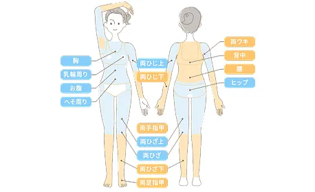 ルシアクリニックの脱毛箇所イメージ画像