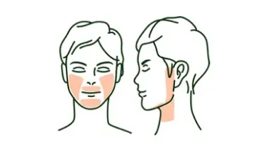 メンズルシアクリニックの脱毛箇所イメージ画像