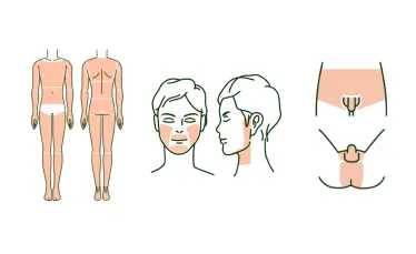 メンズルシアクリニックの脱毛箇所イメージ画像