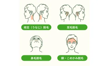 メンズルシアクリニックの脱毛箇所イメージ画像